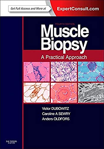 Muscle Biopsy: A Practical Approach: Expert Consult; Online and Print