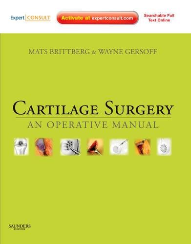 Cartilage Surgery: An Operative Manual, Expert Consult: Online and Print