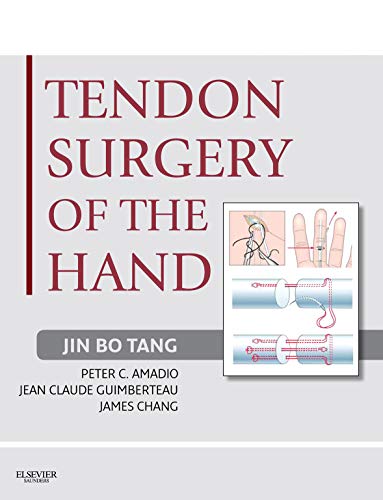Tendon Surgery of the Hand: Expert Consult - Online and Print (English Edition)